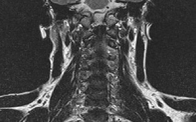 The cervical column